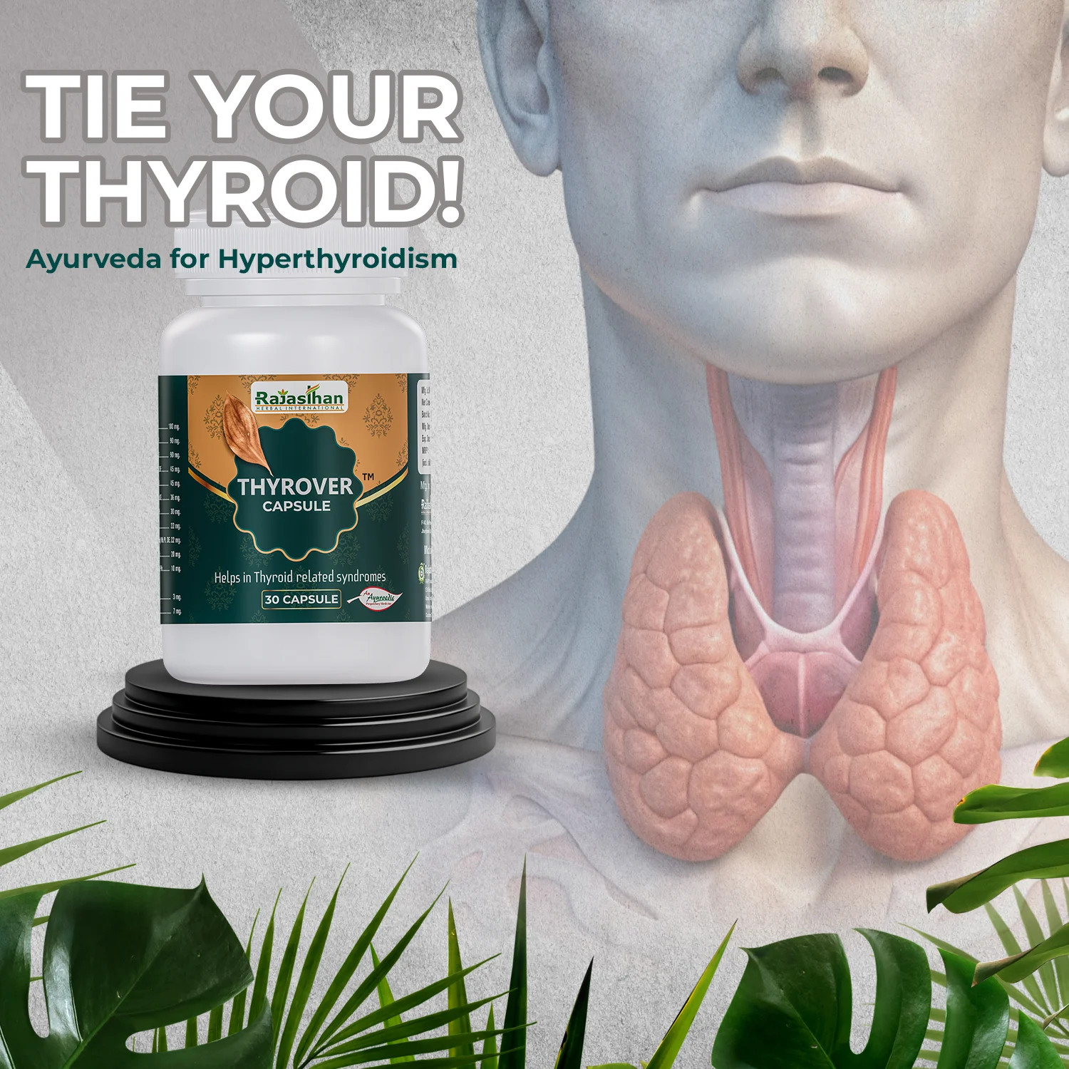 thyrover capsule for hyperthyroidism