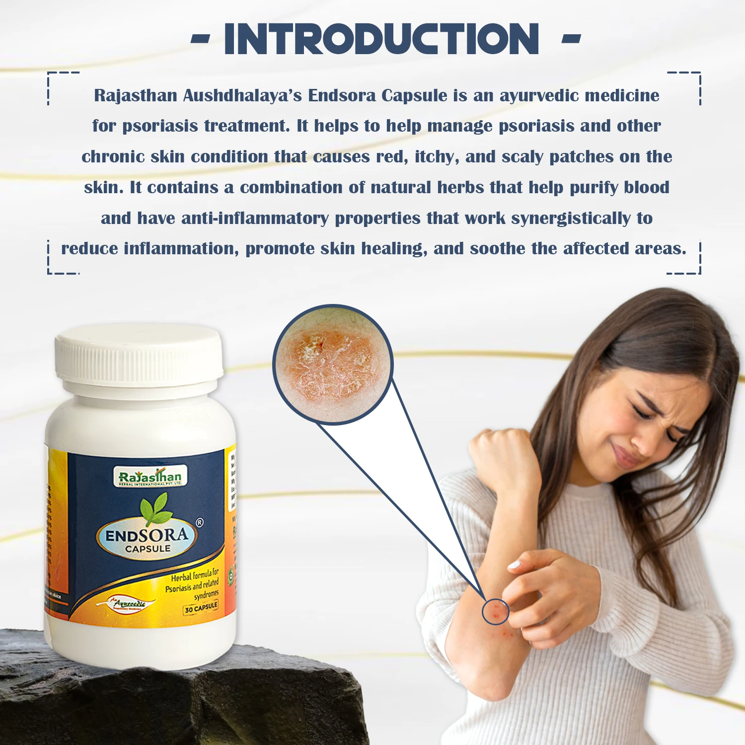 ayurvedic medicine for psoriasis treatment