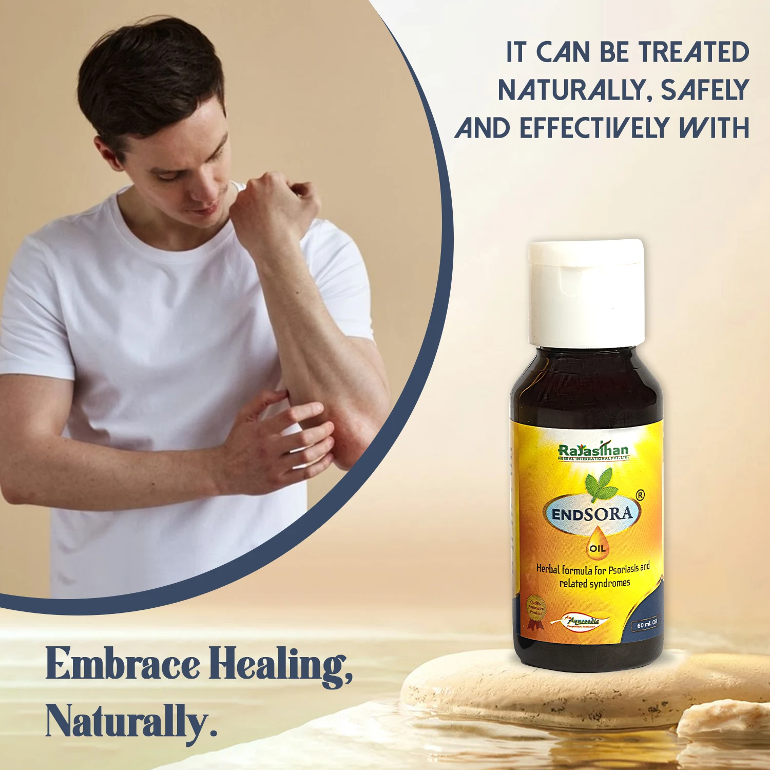 ayurvedic oil for psoriasis