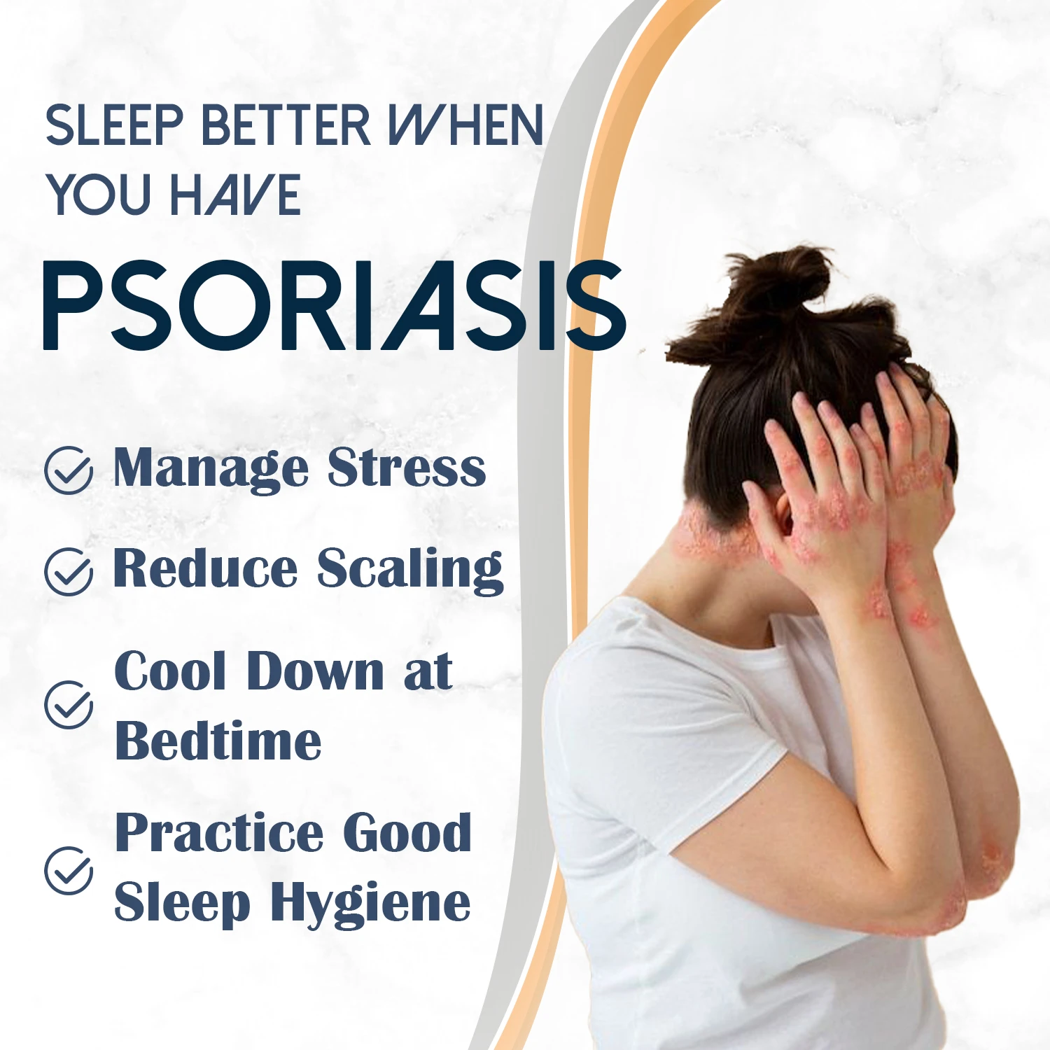 psoriasis symptoms